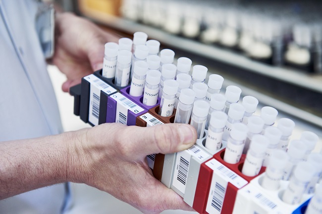 A man holds a box of samples